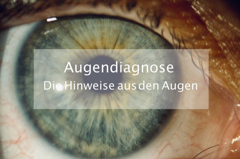 Augendiagnose Berlin Pankow